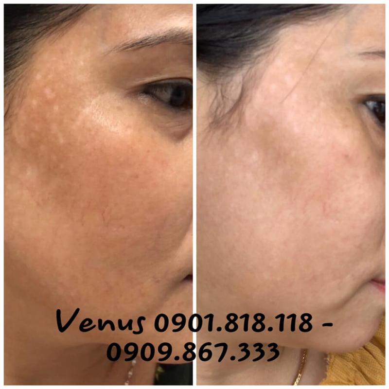 Viện Thẩm Mỹ Venus