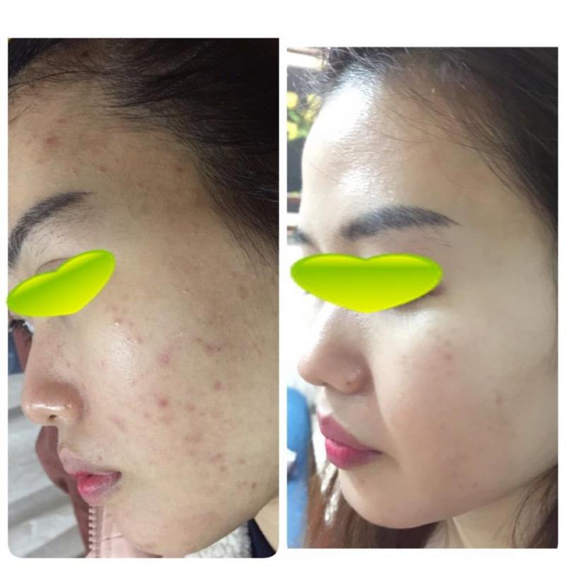 Vskin Spa & Clinic